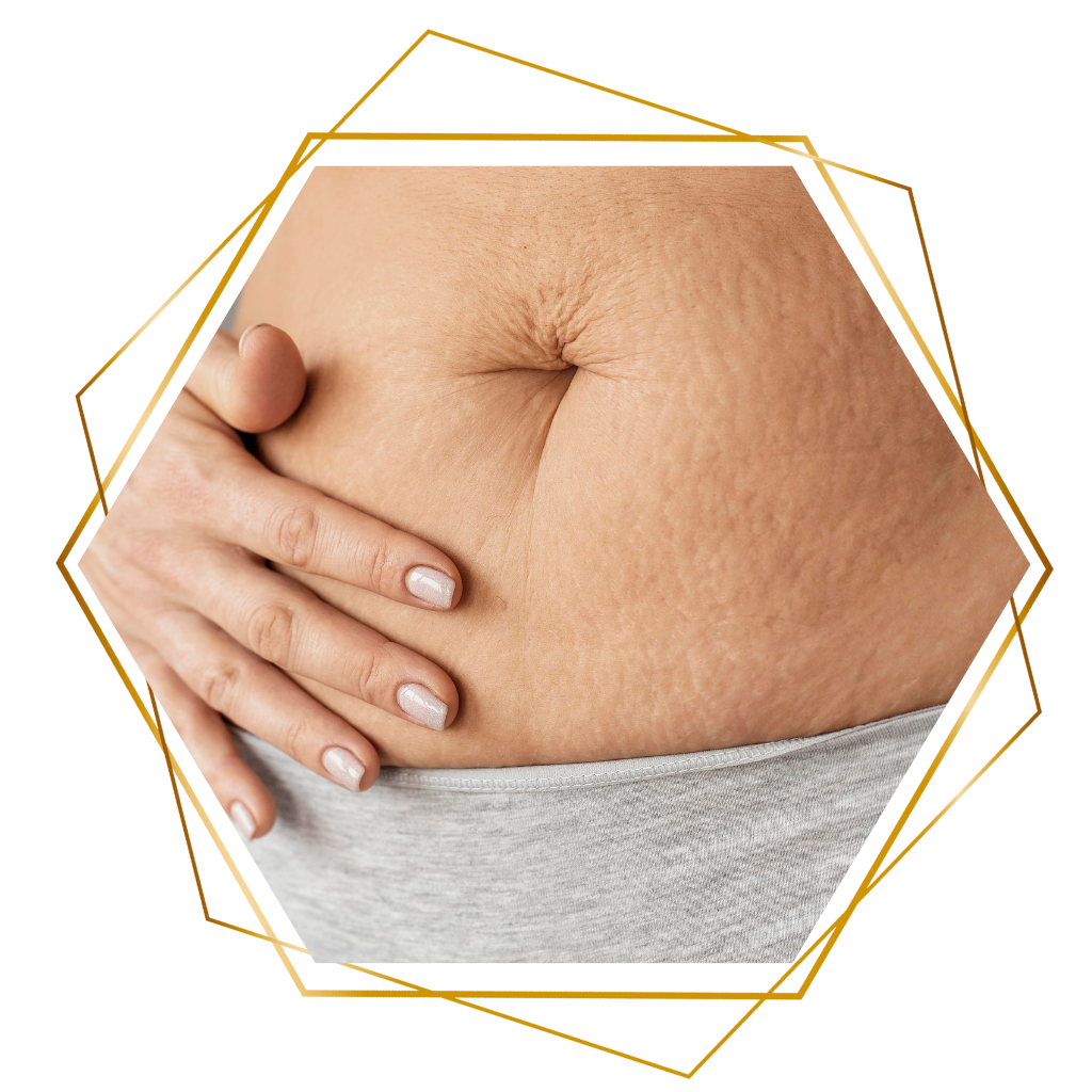 Best Plastic Surgery Clinic in Hyderabad